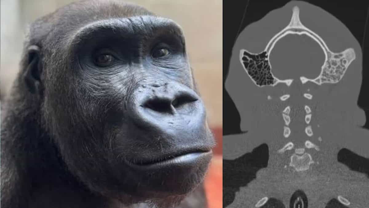 Gorilla Skull Surgery: चिकित्सा जगत में ऐतिहासिक कारनामा! डॉक्टरों ने 12 साल के गोरिल्ला की खोपड़ी से निकाला खतरनाक इन्फेक्शन; बची जान