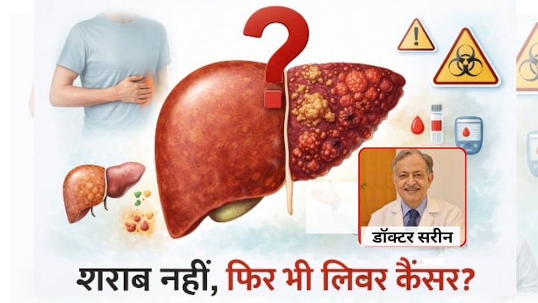 जो शराब को हाथ भी नहीं लगाते, उन्हें क्यों घेर रहा है लिवर कैंसर? 50 साल के अनुभव वाले दिग्गज डॉक्टर ने बताई हैरान करने वाली असली वजह